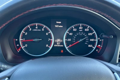 2019 Acura ILX Technology & A-Spec Packages